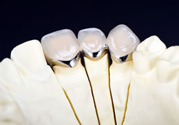 ノリタケスーパーポーセレンAAA